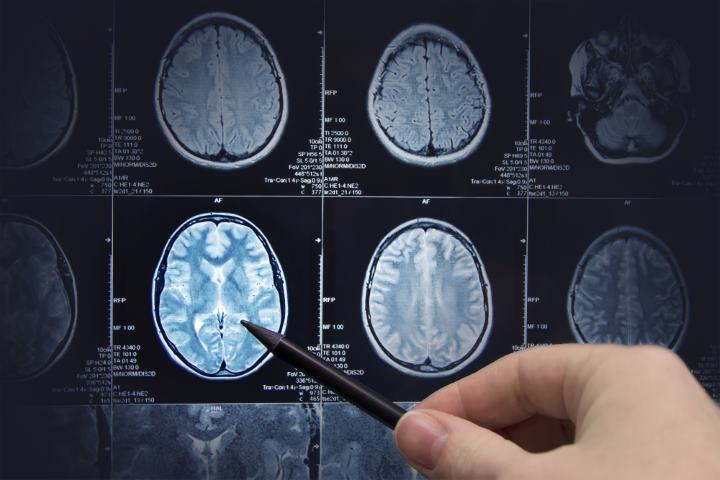 Bio Medical Imaging